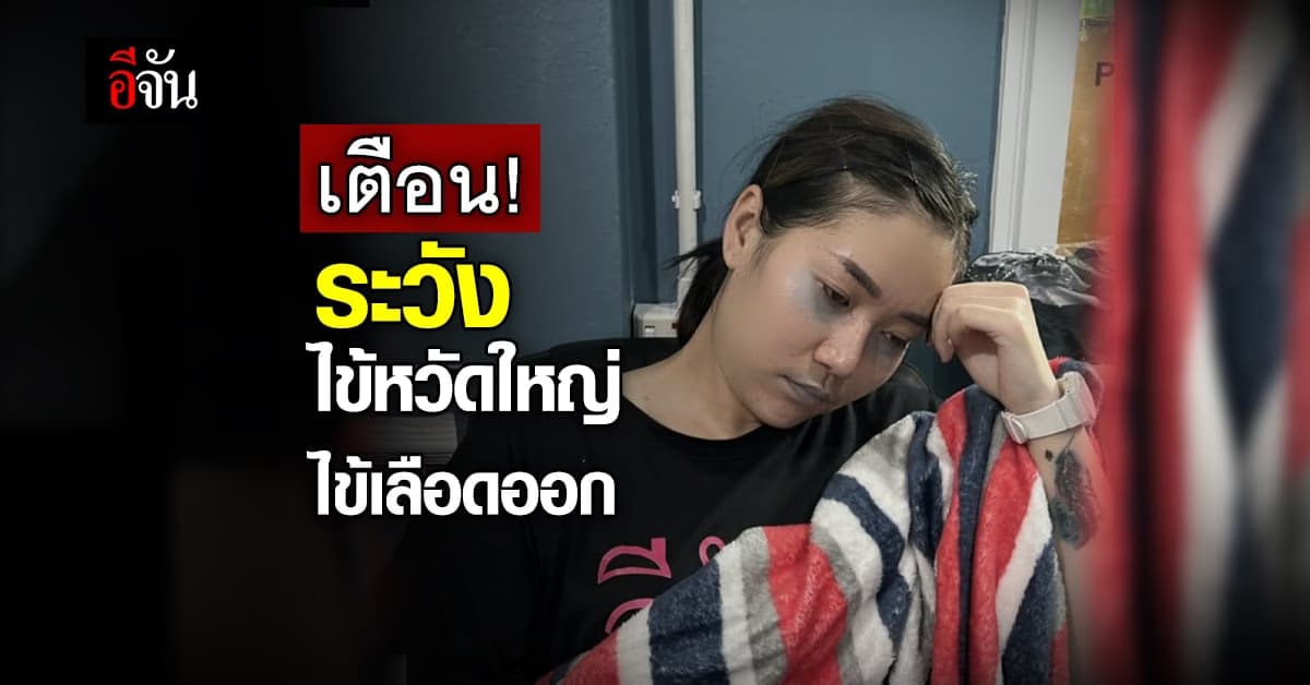 นายกฯ เตือนประชาชน ระวัง ไข้หวัดใหญ่ ไข้เลือดออก แนะสังเกตอาการ