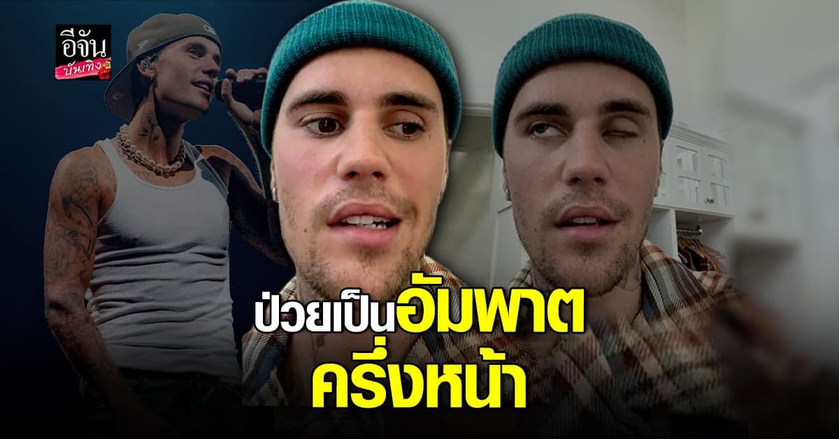 จัสติน บีเบอร์ ป่วยเป็น อัมพาตครึ่งหน้า ต้องเลื่อนคอนเสิร์ต