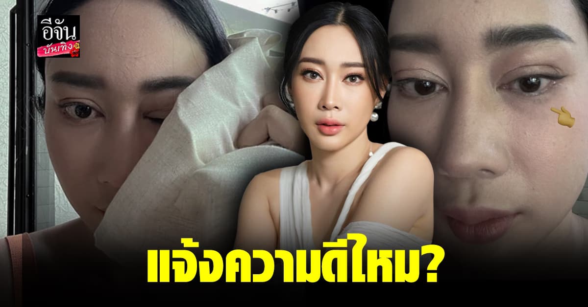 น้ำเพชร โวย ถูกการ์ดปิดประตูรถโดนหน้า ไม่ขอโทษ ควรแจ้งความไหม