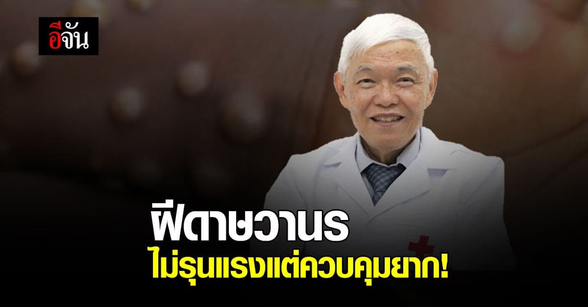 หมอยง แนะจับตา! ฝีดาษวานร ย้ำโรคไม่รุนแรงแต่ควบคุมยาก