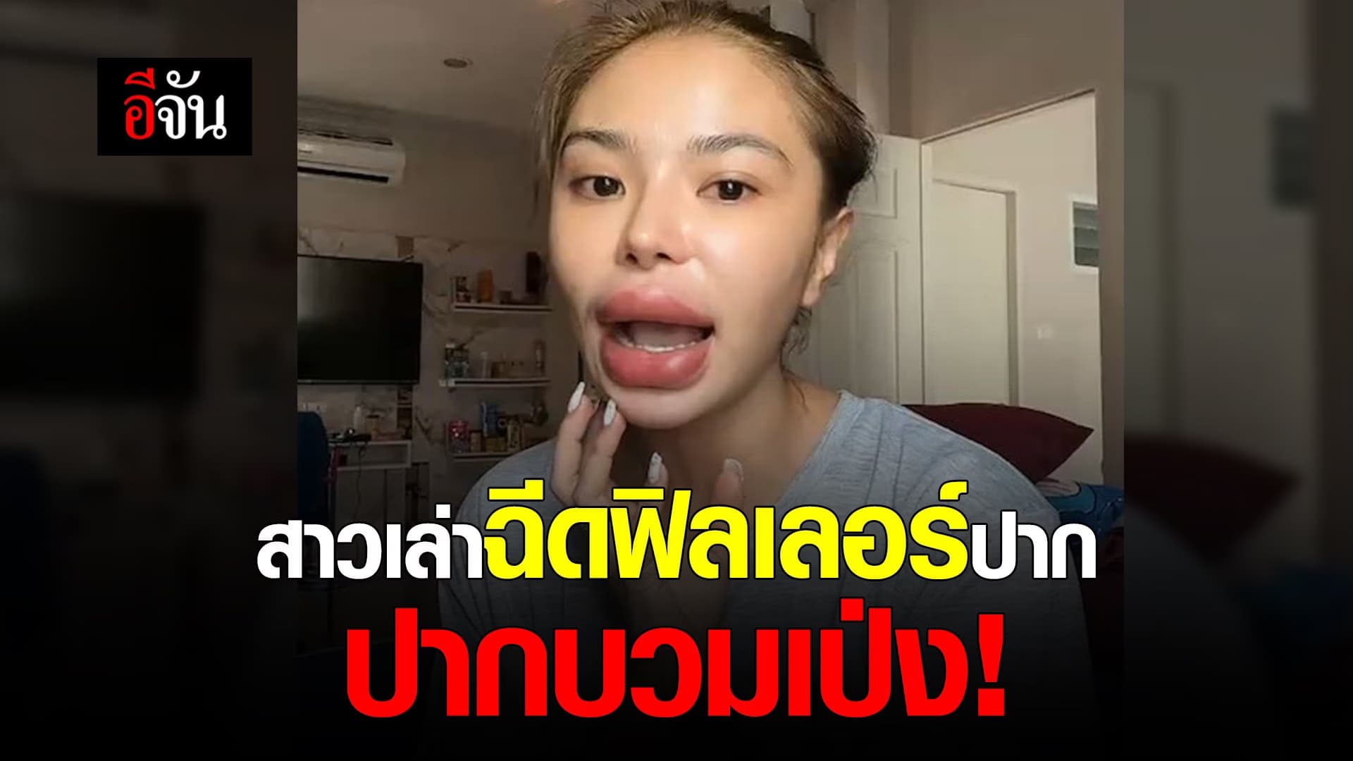 🎬 สาวเล่าฉีดฟิลเลอร์ปาก ปากบวมเป่ง!