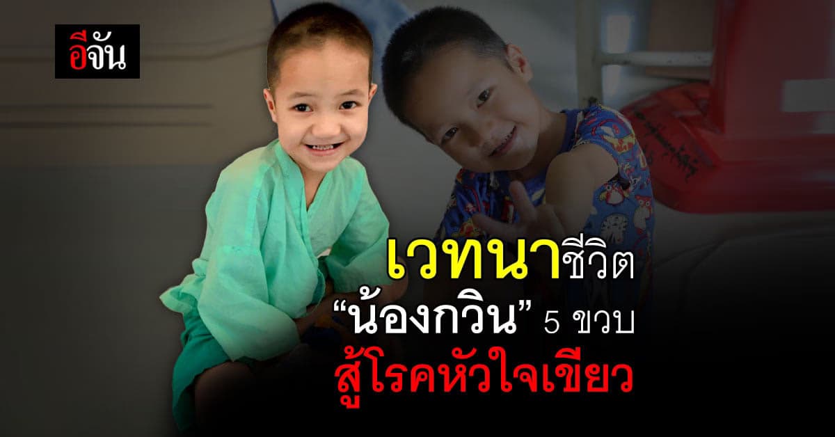 ขอสังคมอีจัน ต่อชีวิต ‘น้องกวิน’ 5 ขวบ สู้โรคหัวใจเขียว