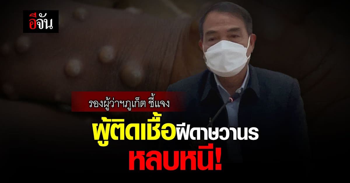 รองผู้ว่าฯ ภูเก็ต ชี้แจง ผู้ติดเชื้อ ฝีดาษวานร ที่หลบหนี!