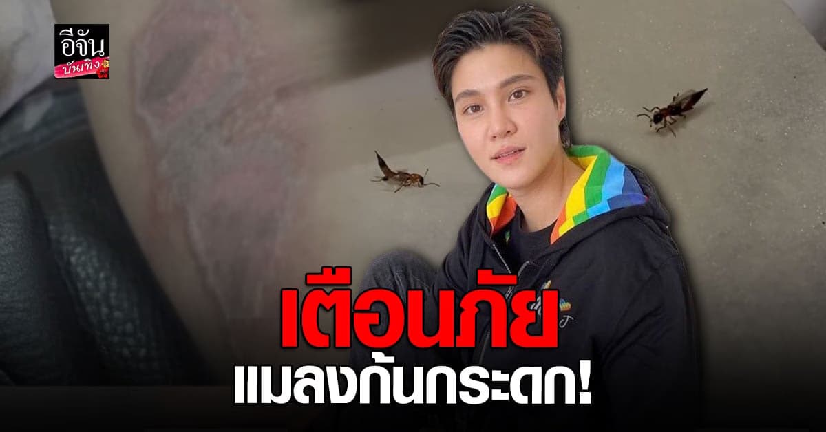 หมอเจี๊ยบ ลลนา เผยรับมือ แมลงก้นกระดก ตัวเล็กแต่มีพิษร้ายแรง