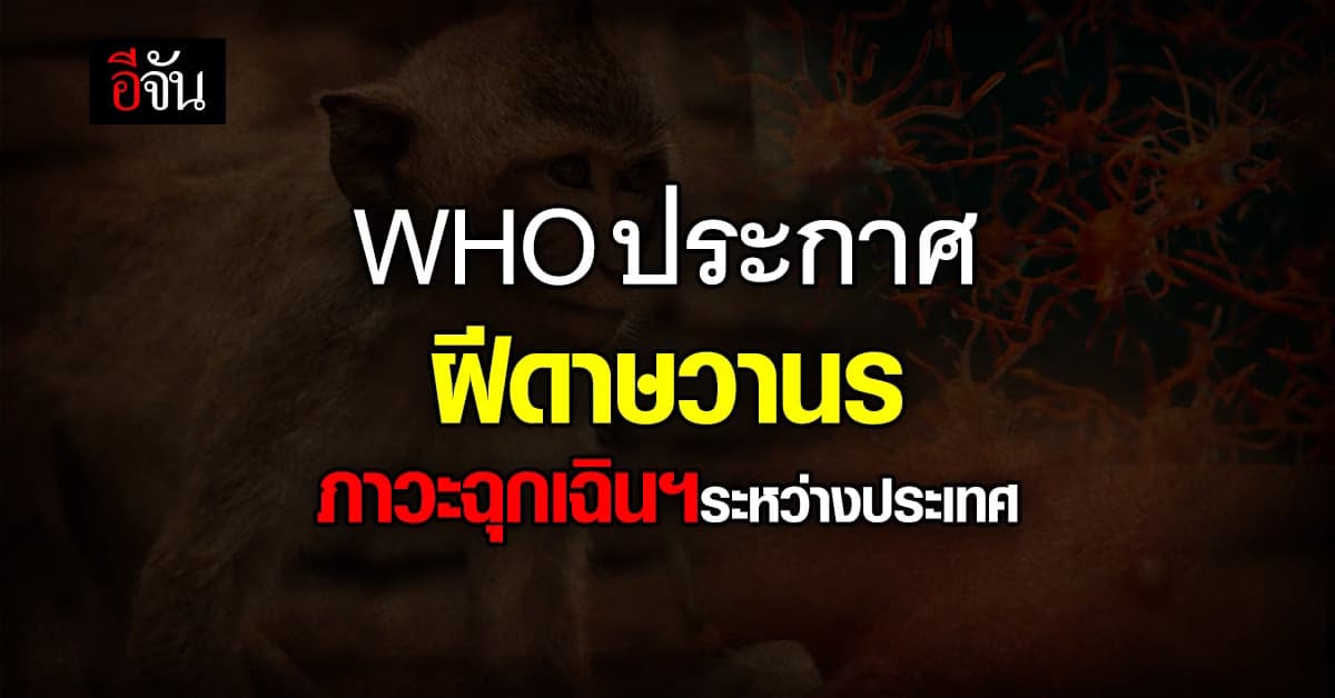 WHO ประกาศ ฝีดาษวานร ภาวะฉุกเฉินฯระหว่างประเทศ