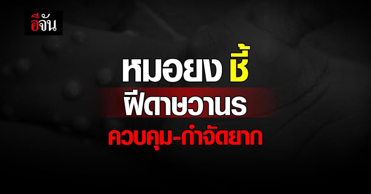 หมอยง ชี้ฝีดาษวานร ควบคุม-กำจัดยาก