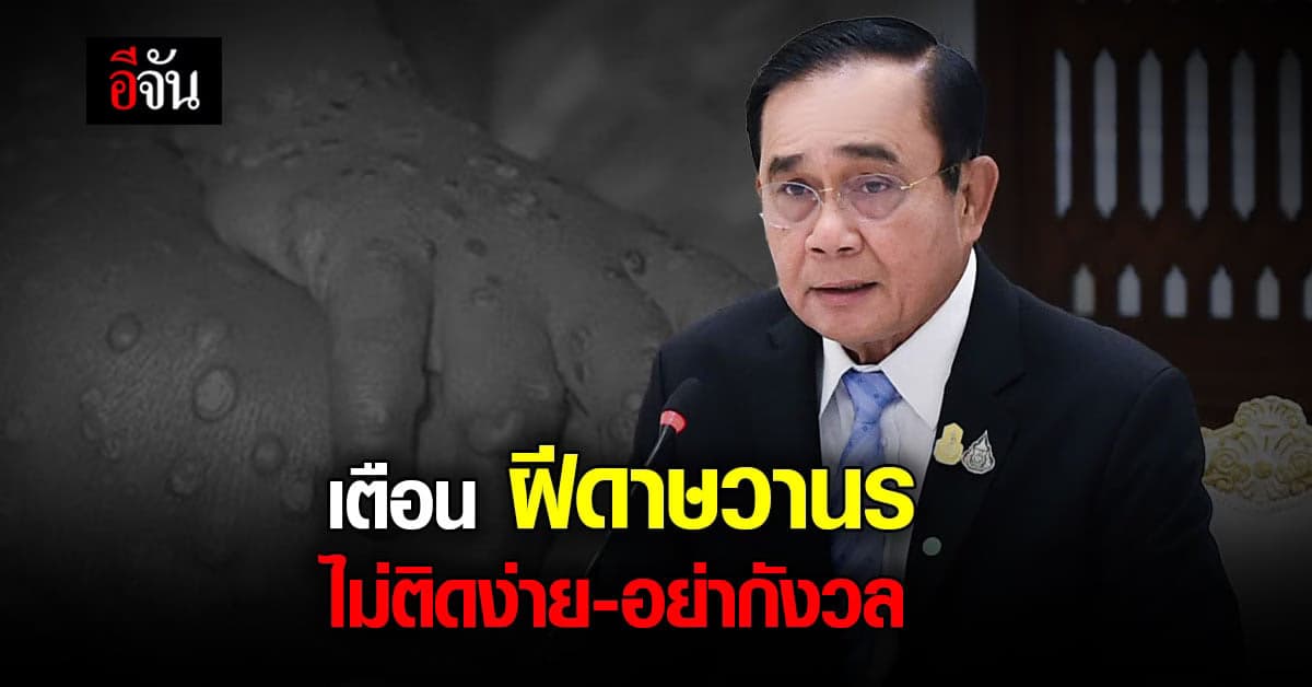 นายกฯ เตือน อย่ากังวลฝีดาษวานร ไม่ติดต่อง่าย แต่เลี่ยงพฤติกรรมเสี่ยง