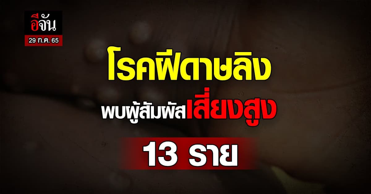กรมควบคุมโรคเผย โรคฝีดาษลิง พบผู้สัมผัสเสี่ยงสูง 13 ราย