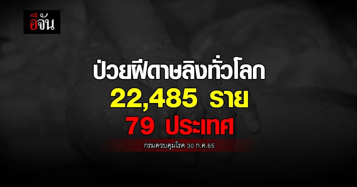 กรมควบคุมโรค คัดกรองเข้มคนเดินทางเข้าประเทศ ป้องกันฝีดาษลิง