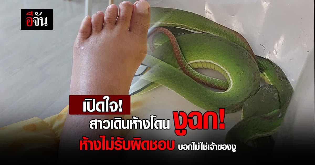 เปิดใจ! สาวเดินห้างโดน งูฉก! ห้างไม่รับผิดชอบ บอกไม่ใช่เจ้าของงู