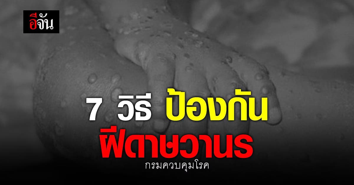 กรมควบคุมโรค แนะ 7 วิธี ป้องกันโรคฝีดาษวานร