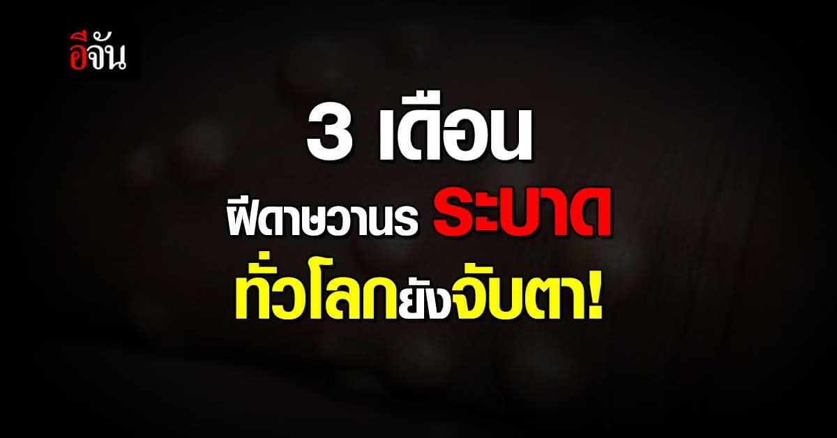 3 เดือน ฝีดาษวานรระบาด ทั่วโลกยังจับตา!