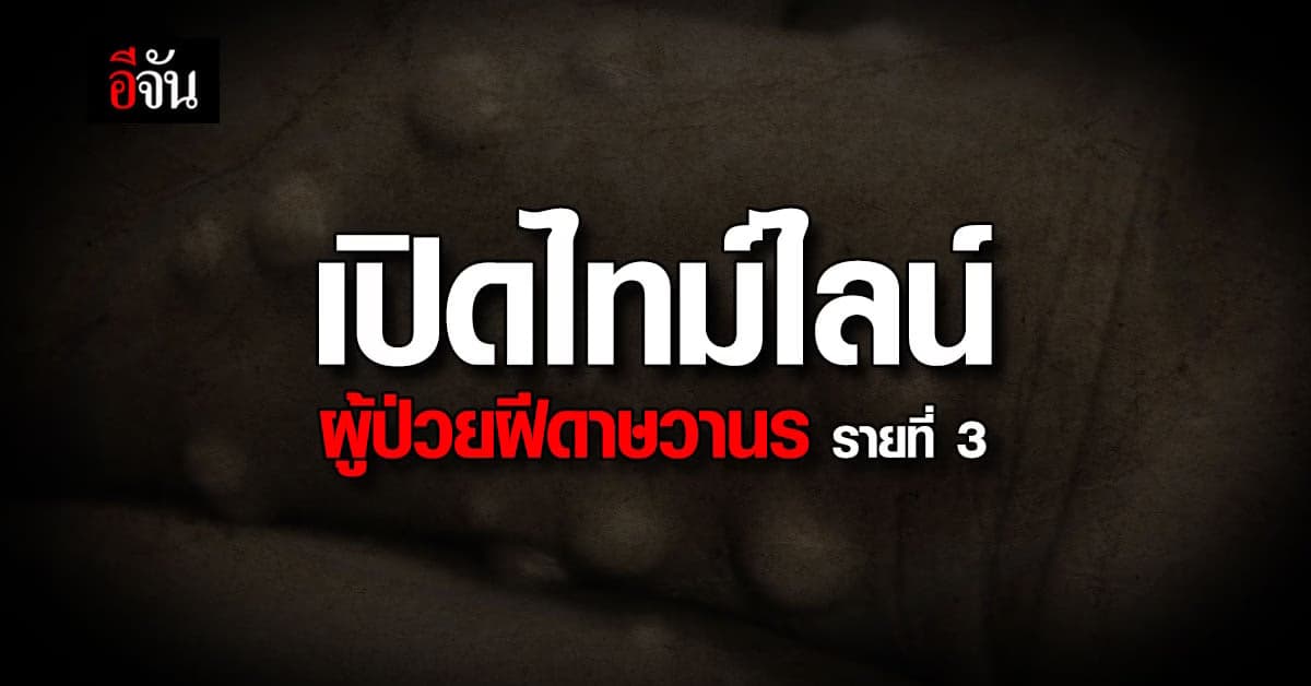 เปิดไทม์ไลน์ ผู้ป่วยฝีดาษวานร รายที่ 3 ของไทย ที่ จ.ภูเก็ต