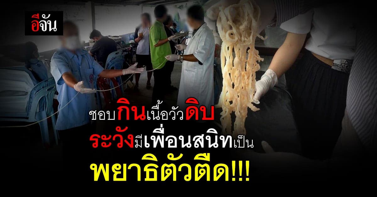 เตือน! กินเนื้อวัวดิบ เสี่ยงเจอพยาธิตัวตืดในลำไส้