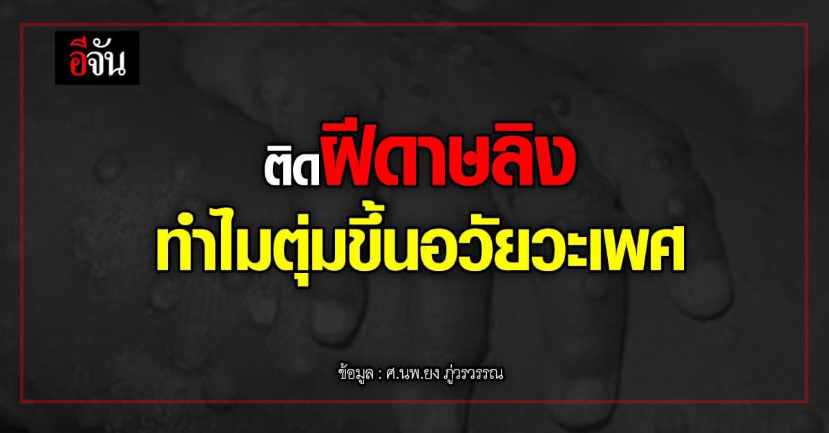 หมอยง เผยคำตอบผู้ป่วย ฝีดาษลิง ทำไมมีตุ่มขึ้นอวัยวะเพศ