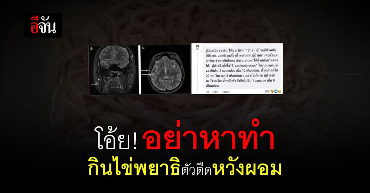 หมอแล็บแพนด้า โพสต์สาวอยากผอมกินไข่พยาธิตัวตืด!