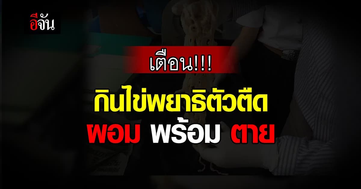 กรมอนามัย ย้ำ! กินไข่พยาธิตัวตืดอันตราย เสี่ยงตายมากกว่าผอม