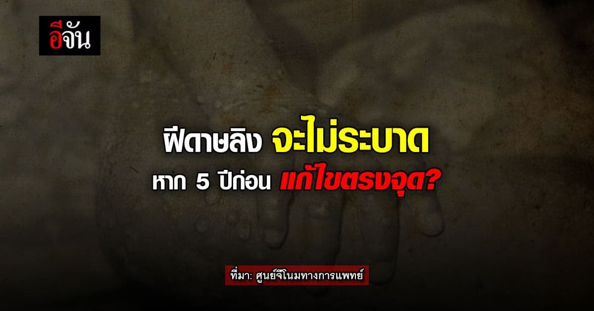 แพทย์ไนจีเรีย ต้นเหตุ ฝีดาษลิง ระบาด : ศูนย์จีโนมทางการแพทย์