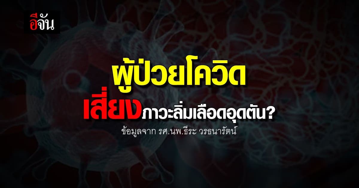 หมอธีระ เผยวิจัย ผู้ป่วยโควิด เสี่ยง ภาวะลิ่มเลือดอุดตัน