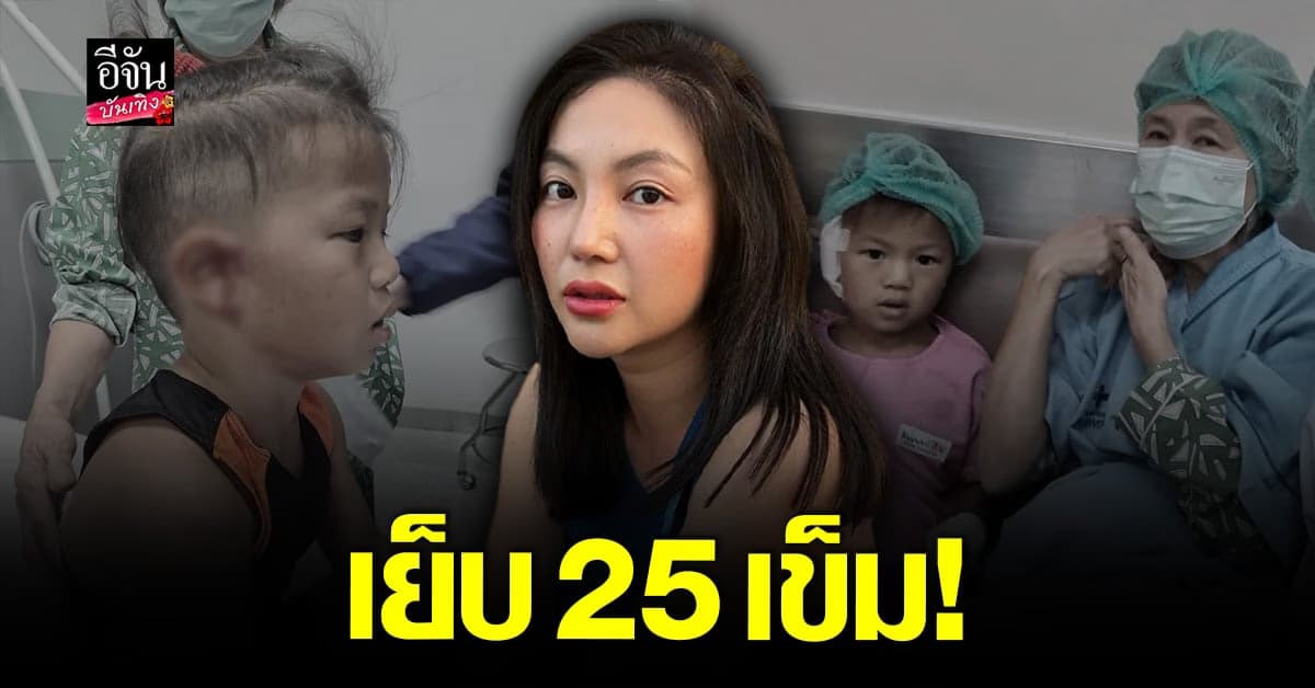 ฮารุ ใจสั่น น้องเอเดน ล้มหูฟาดขอบเตียง เย็บ 25 เข็ม