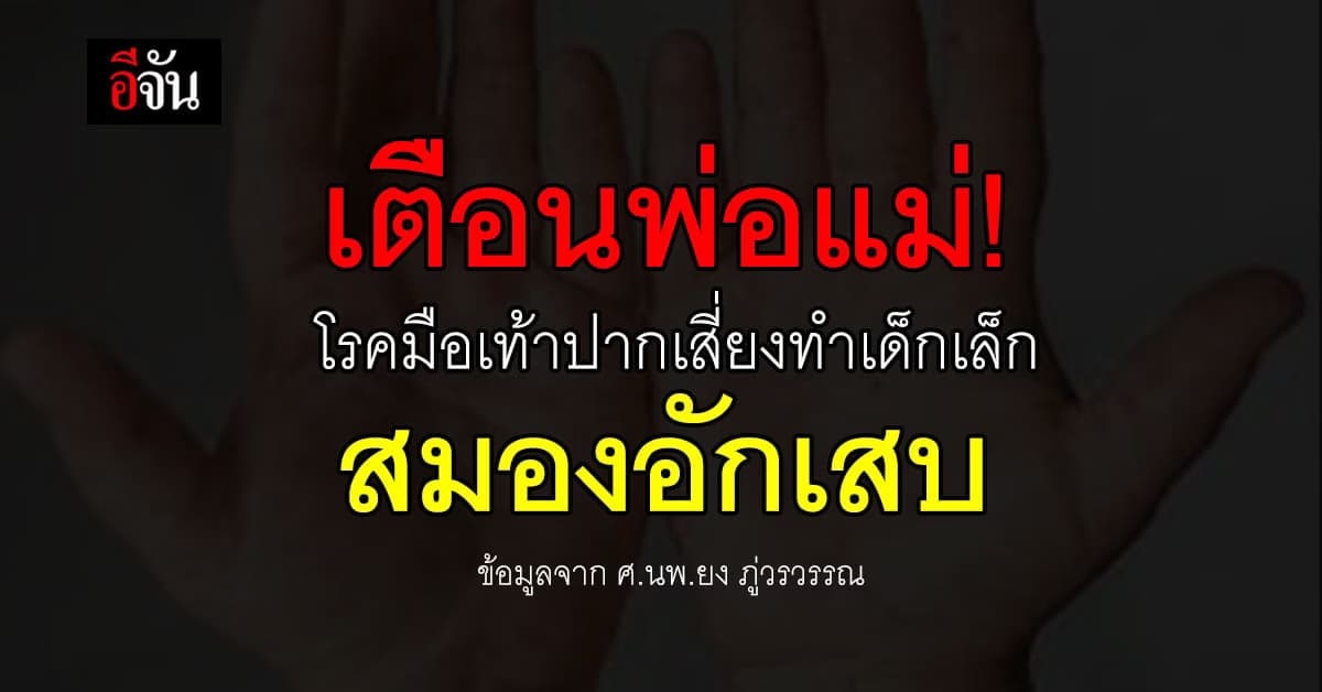 “หมอยง” เผย โรคมือเท้าปาก ตัวรุนแรงที่สุด เสี่ยงทำเด็กเล็กสมองอักเสบ