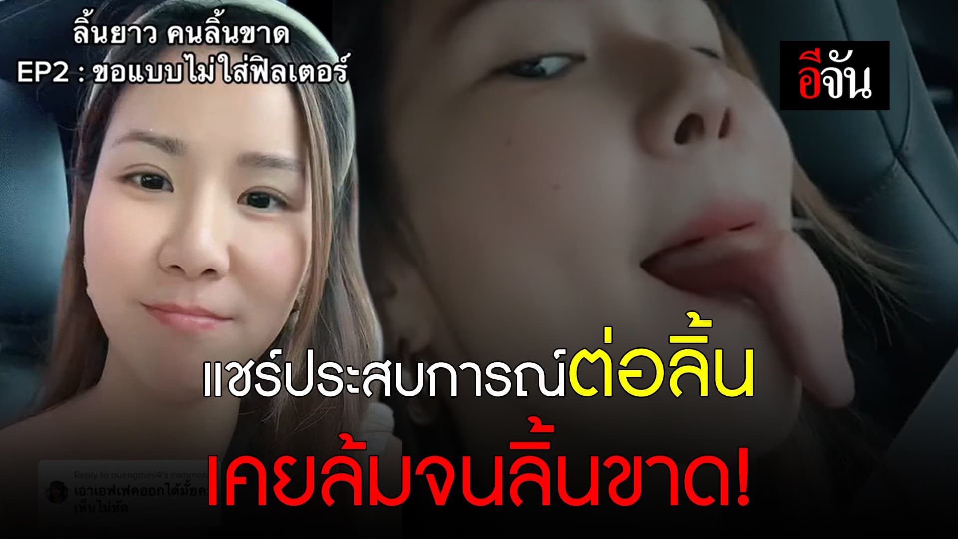 🎬 แชร์ประสบการณ์ต่อลิ้น  เคยล้มจนลิ้นขาด!