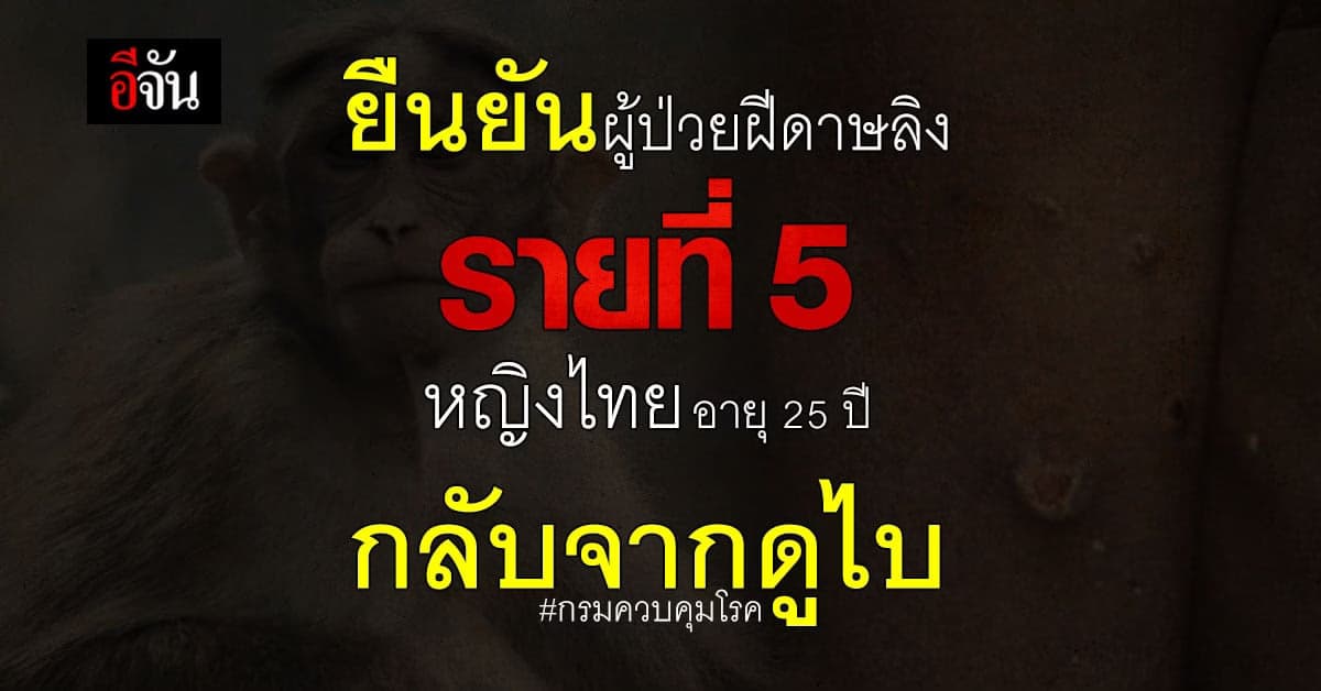 กรมควบคุมโรค พบผู้ป่วย ฝีดาษวานร ยืนยัน เป็นรายที่ 6 ที่ จ.มหาสารคาม