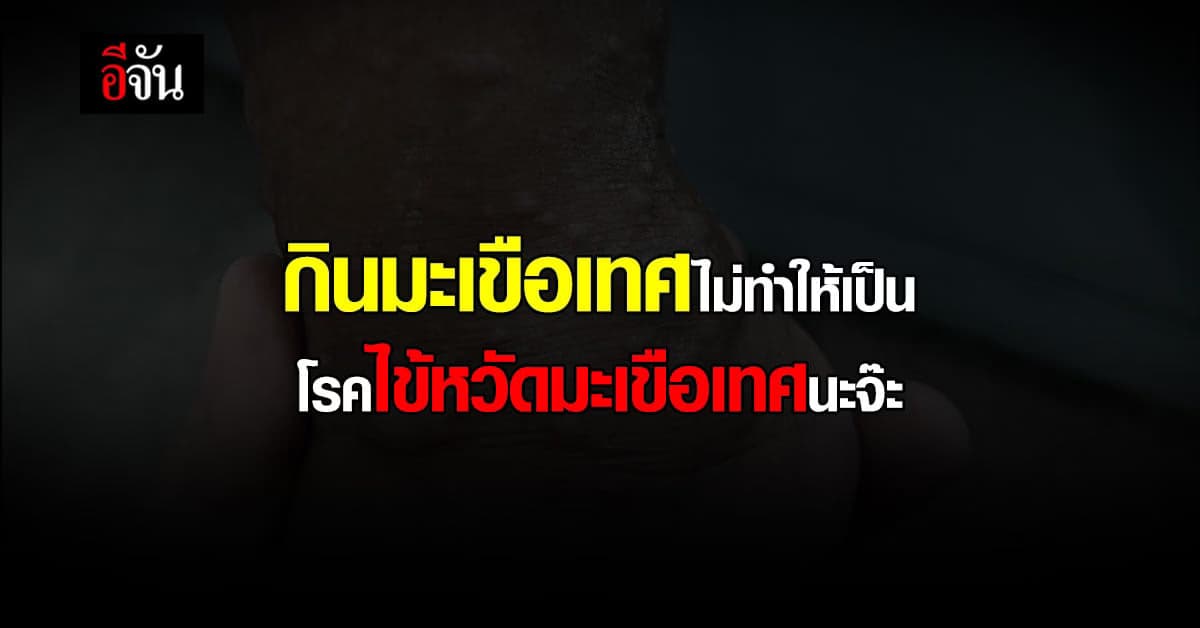 โรคไข้หวัดมะเขือเทศ อาการคล้าย โรคมือเท้าปาก ไม่ใช่เชื้อชนิดใหม่