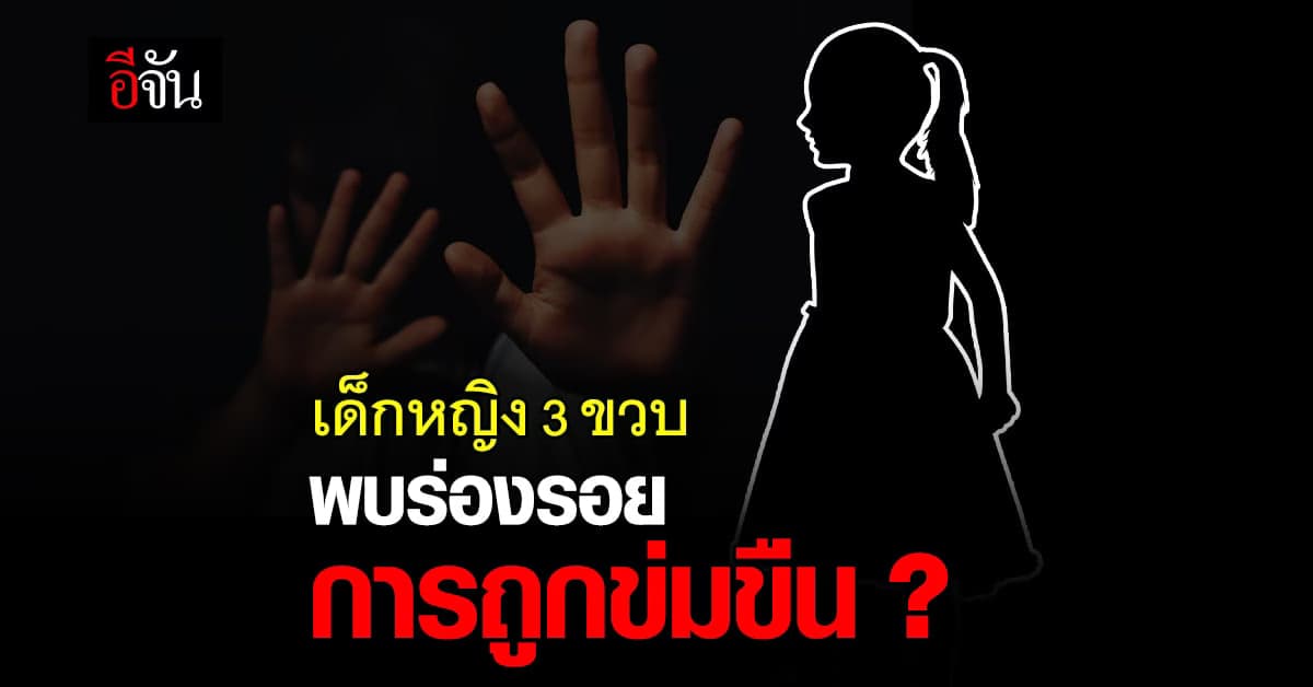 เจอแผลเพิ่มที่อวัยวะเพศ คดี ด.ญ. 3 ขวบ คาดโดนแม่ พ่อเลี้ยงทำร้าย