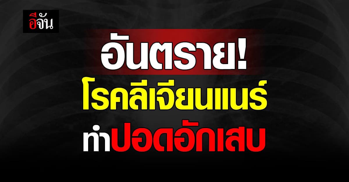 รู้จัก โรคลีเจียนแนร์ เชื้อแบคทีเรีย ทำให้ปอดอักเสบ