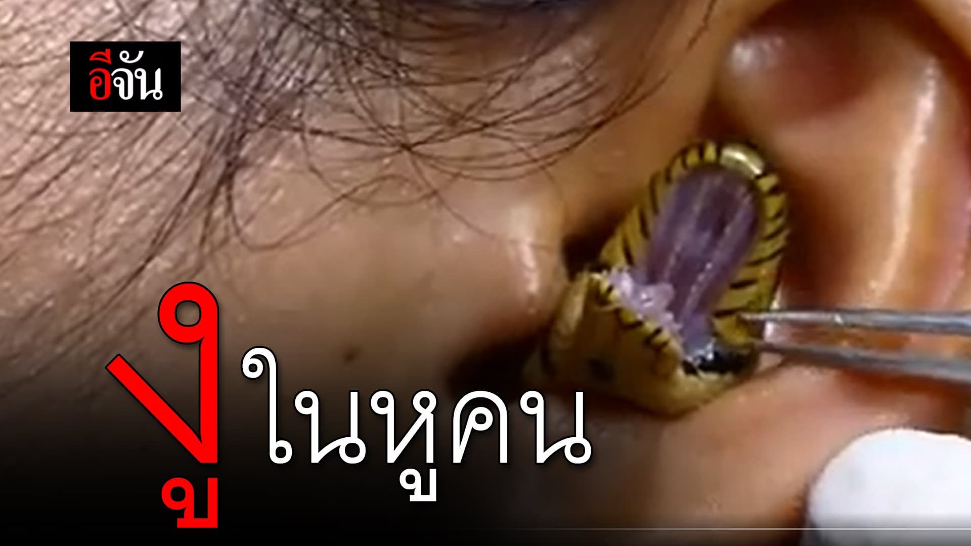 🎬 งูในหูคน