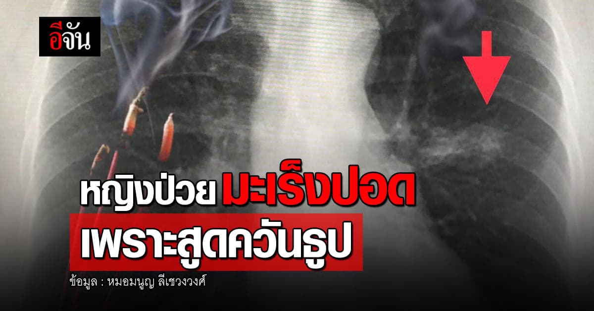 รู้ไหม ? ไม่ได้สุบบุหรี่ก็ทำให้เป็นมะเร็งปอดได้