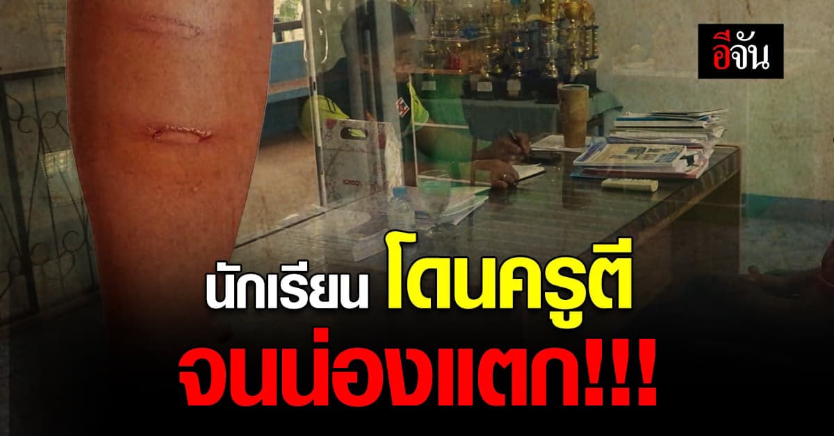 ครูตีนักเรียน จนน่องแตก เพราะไปโรงเรียนสาย บทลงโทษนี้เกินไปไหม ?