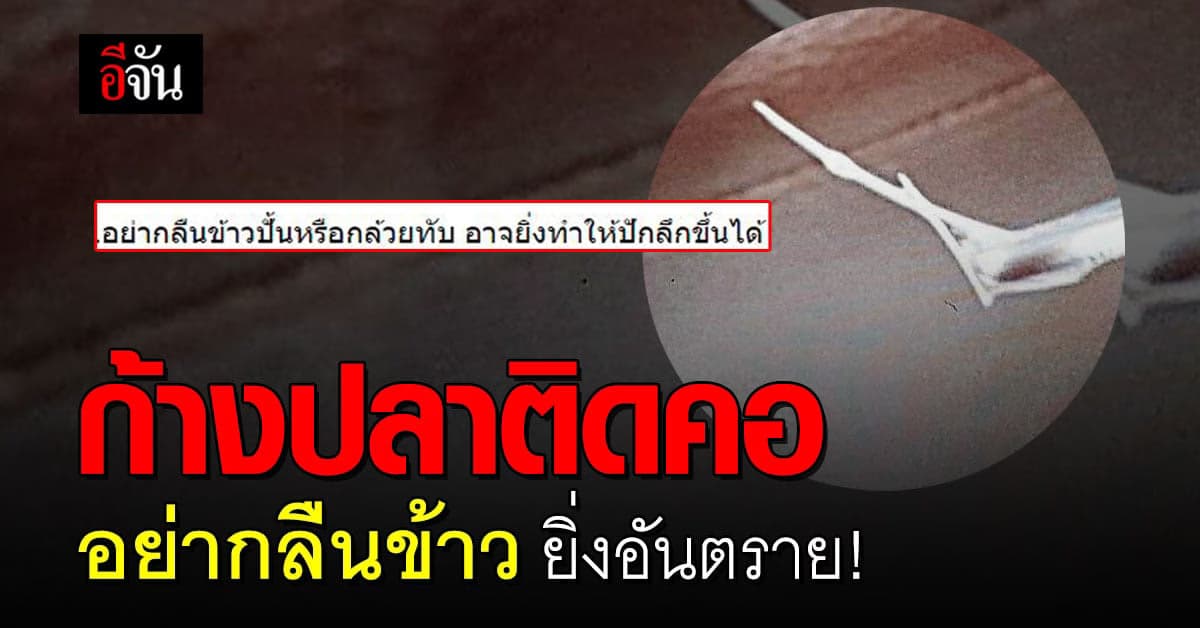 แพทย์หญิง เตือน ก้างปลาติดคอ อย่ากลืนข้าว ยิ่งอันตราย