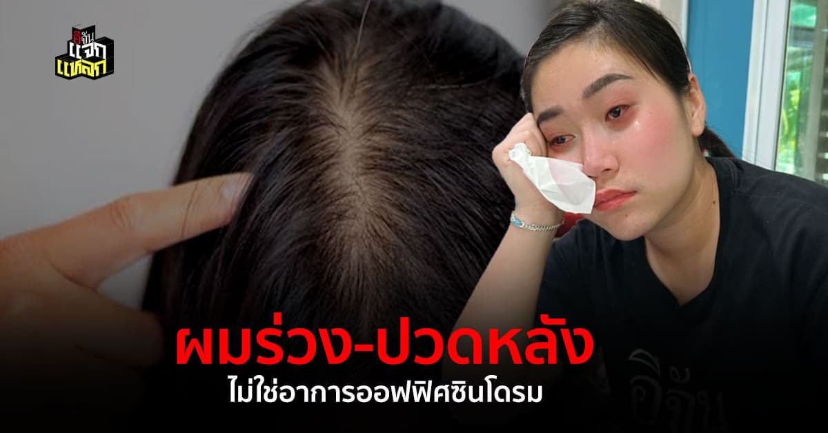 ข่าวปลอม อย่าแชร์! ผมร่วงและปวดหลังเป็นอาการของโรคออฟฟิศซินโดรม