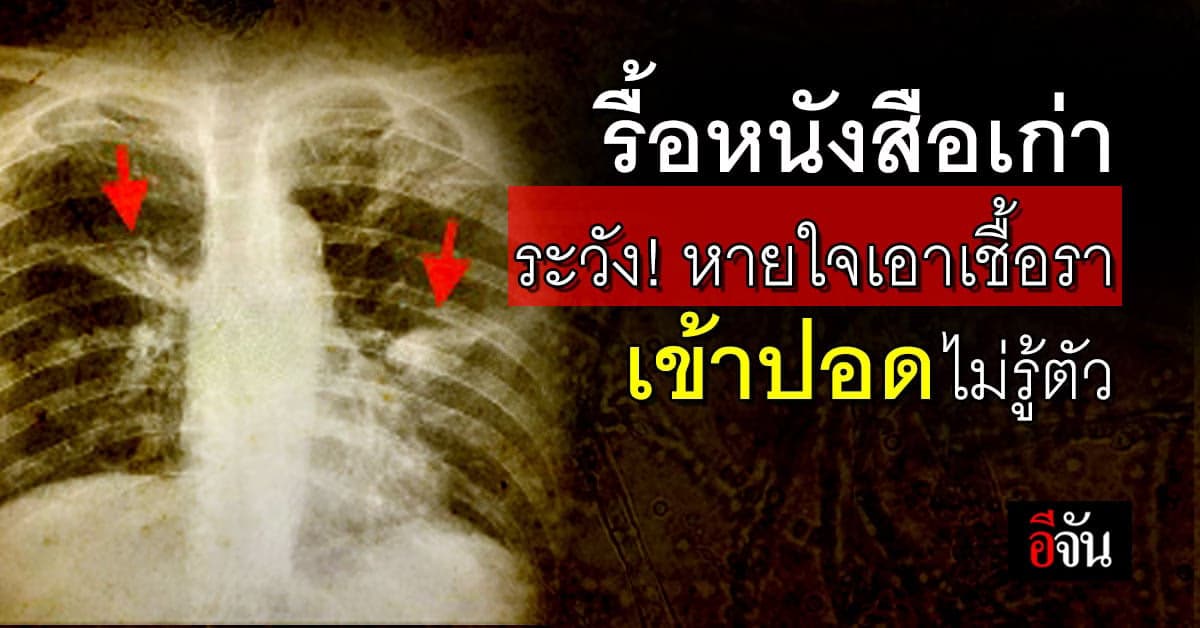 อันตราย! รื้อหนังสือเก่าต้องระวัง หายใจเอาเชื้อราเข้าปอดไม่รู้ตัว