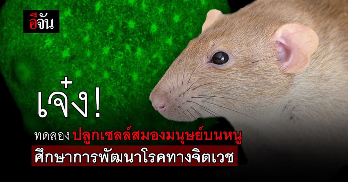ค้นพบการพัฒนาโรคทางจิตเวช โดยการทดลองปลูกเซลล์สมองมนุษย์บนหนู