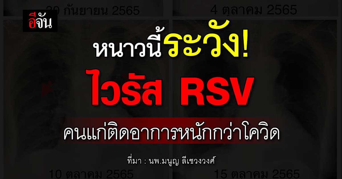 ระวัง! ไวรัส RSV กำลังระบาด คนแก่ติดอาการหนักกว่าเด็ก