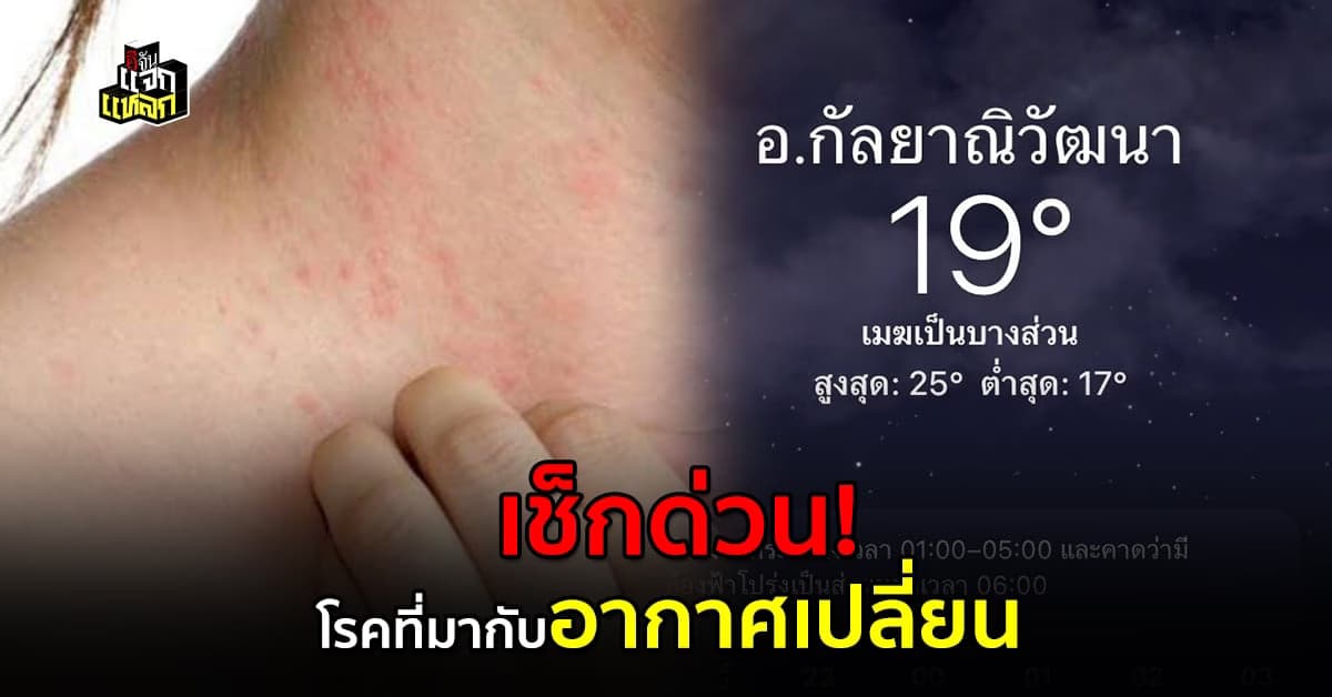เช็กด่วน โรคที่มากับอากาศเปลี่ยน คนขี้เเพ้เตรียมรับมือ
