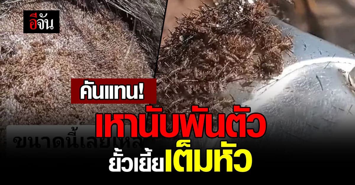 ขนลุก คนไร้บ้านมาพร้อมกับเหานับพันตัว เห็นแล้วคันหัว