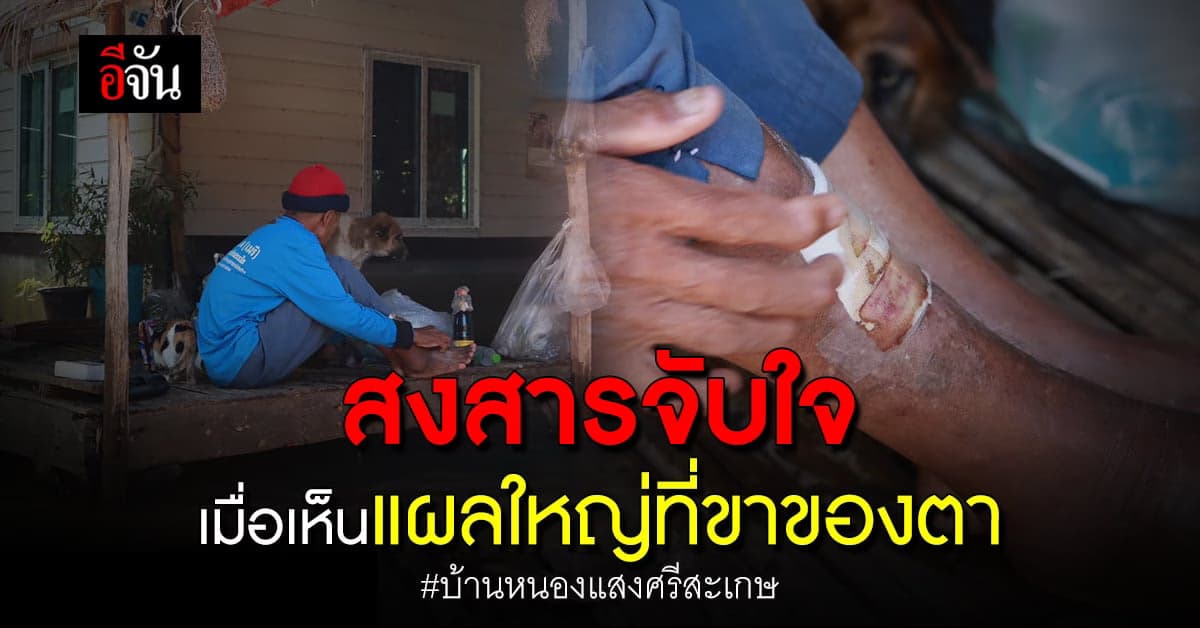 สงสารจับใจ เมื่อเห็นแผลใหญ่ที่ขาของตา บ้านหนองแสง จ.ศรีสะเกษ