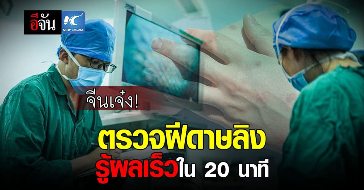 จีนพัฒนาวิธีตรวจ “ฝีดาษลิง” แบบรู้ผลใน 20 นาที