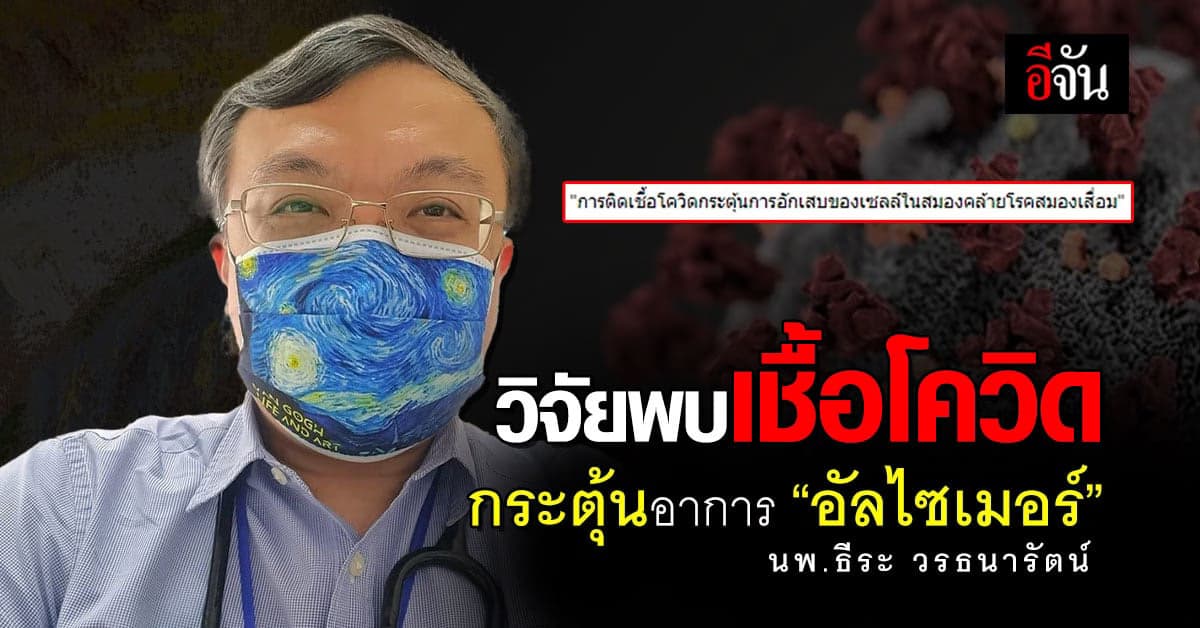 หัวจะปวดกับโควิด วิจัยพบกระตุ้นอาการ “อัลไซเมอร์”