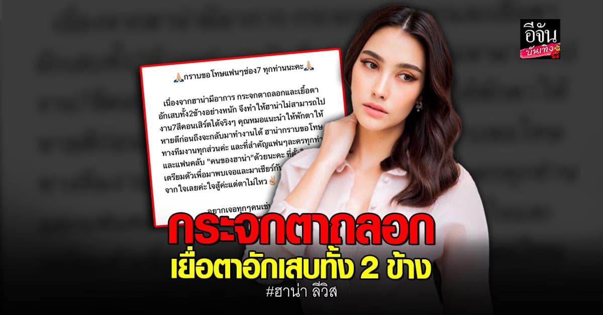 ฮาน่า ลีวิส ป่วย กระจกตาถลอกและเยื่อตาอักเสบทั้ง 2 ข้างอย่างหนัก