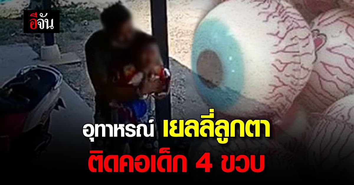 อุทาหรณ์ เยลลี่ลูกตาพลาดติดคอเด็ก เกือบช่วยไม่ทัน