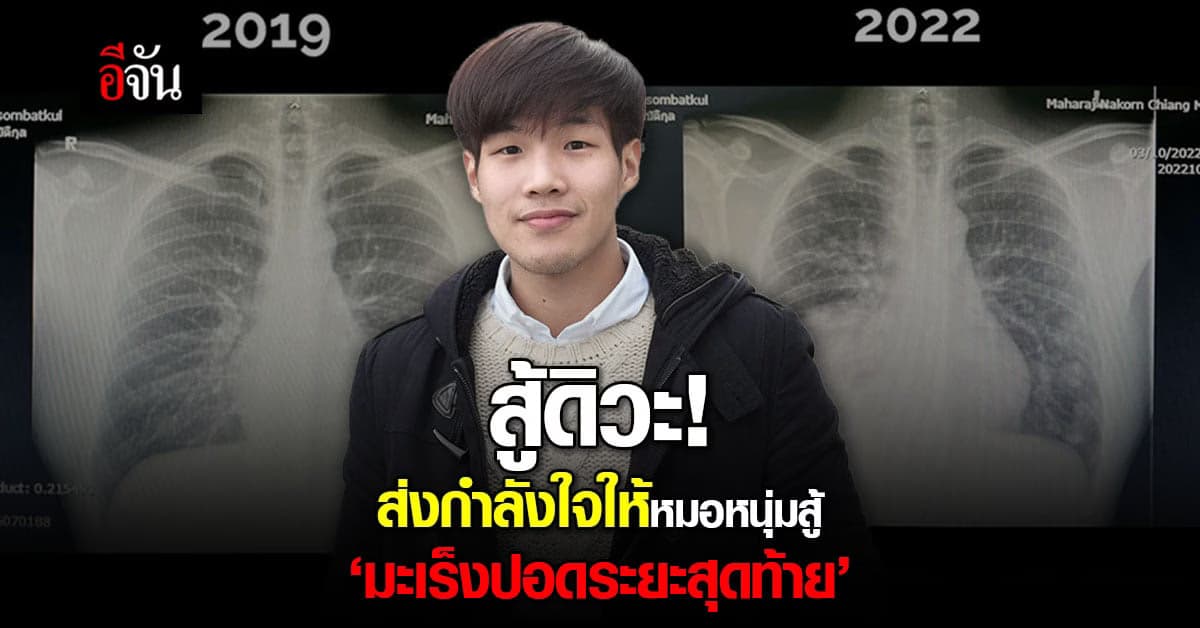 หมอหนุ่ม เปิดเพจ สู้ดิวะ เล่าเรื่องเป็นมะเร็งปอดระยะสุดท้าย