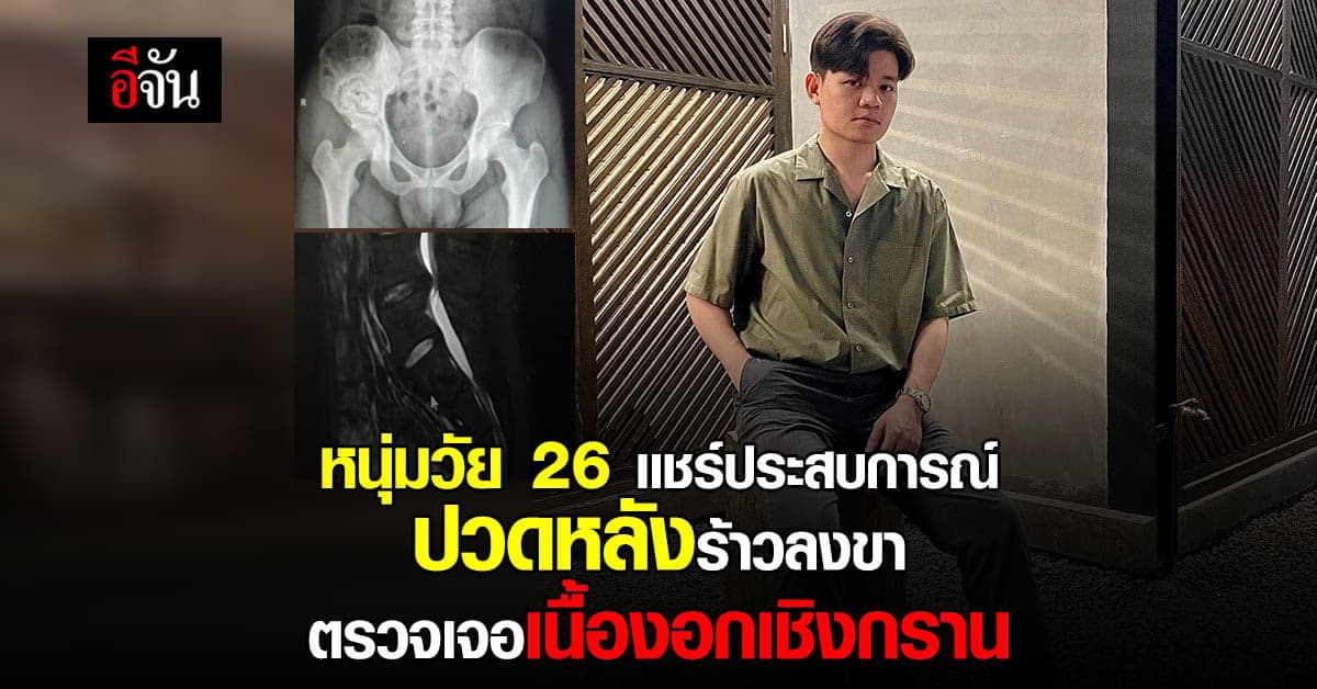 ส่งกำลังใจให้อีกคน! หนุ่มอายุ 26 ร่างกายเเข็งเเรง ตรวจเจอ เนื้องอก