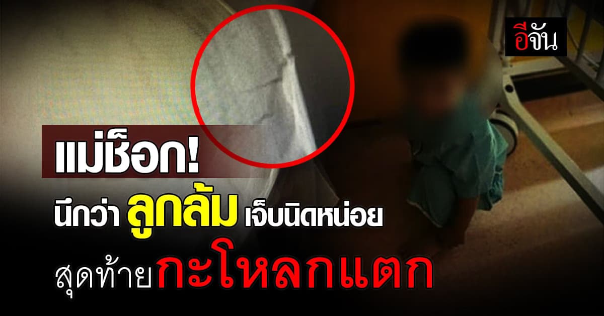 จุกอกคนเป็นแม่ คิดว่าลูกลื่นล้มธรรมดา ผ่านไป 1 อาทิตย์ พบ กะโหลกแตก