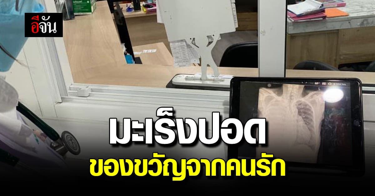 หญิงวัย 50 ปี ตรวจเจอมะเร็งปอด เพราะมีสามี สูบบุหรี่