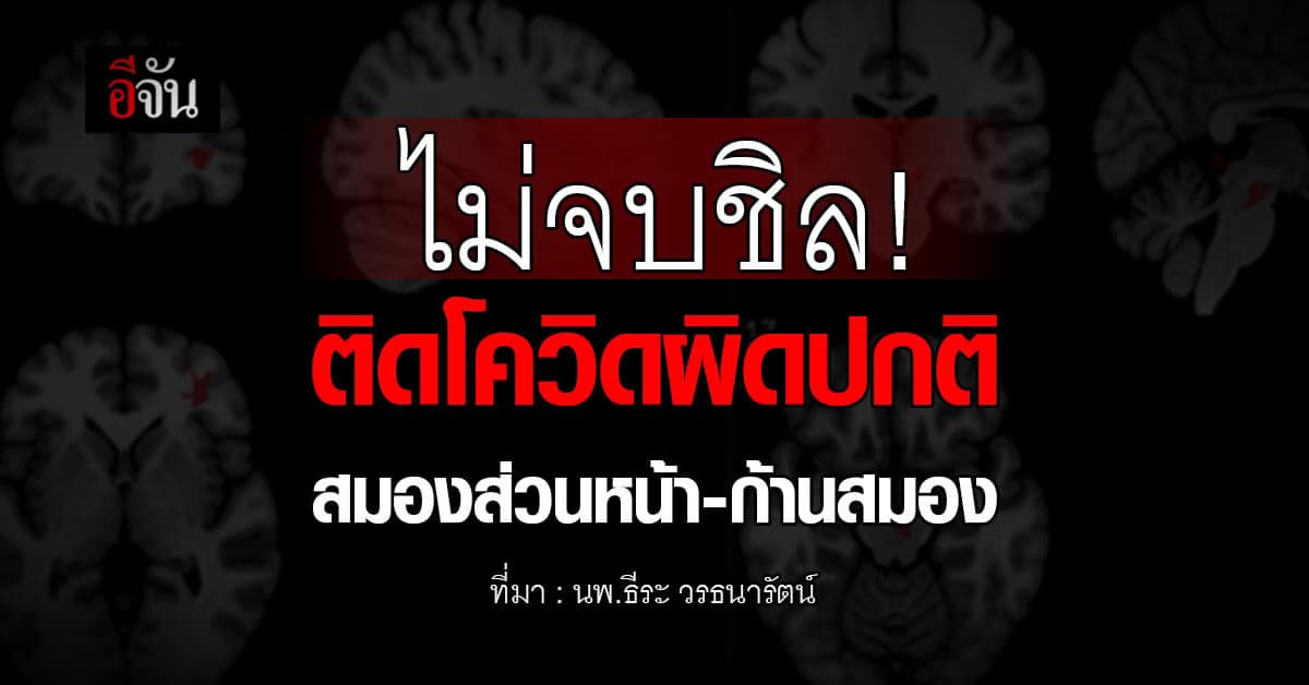 วิจัย เผย ติดโควิดพบผิดปกติสมองส่วนหน้า-ก้านสมอง